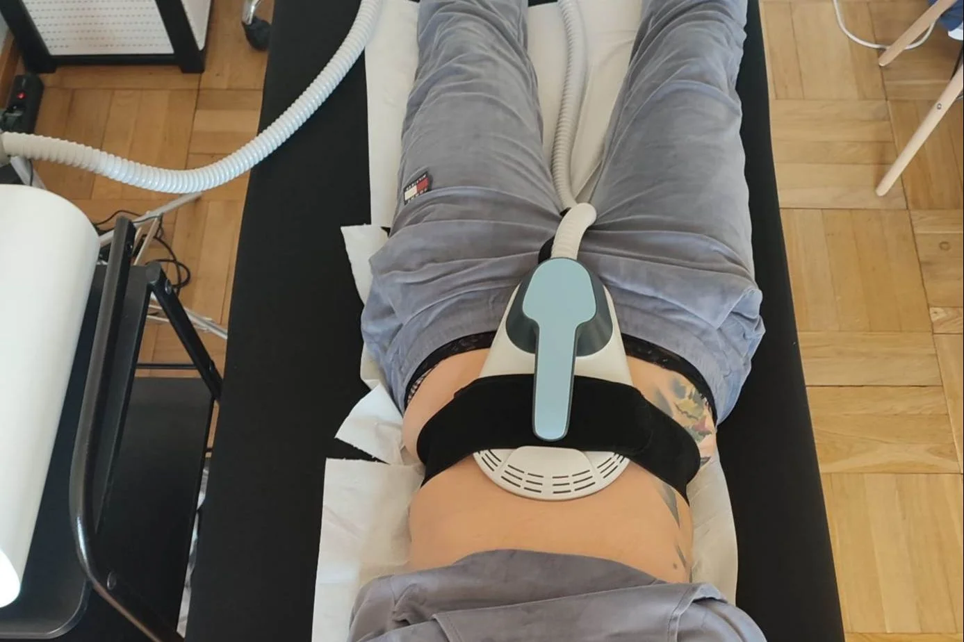 Fala uderzeniowa w trakcie zabiegu brzucha