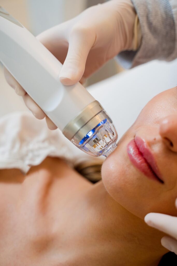 Radiofrekwencja mikroigłowa